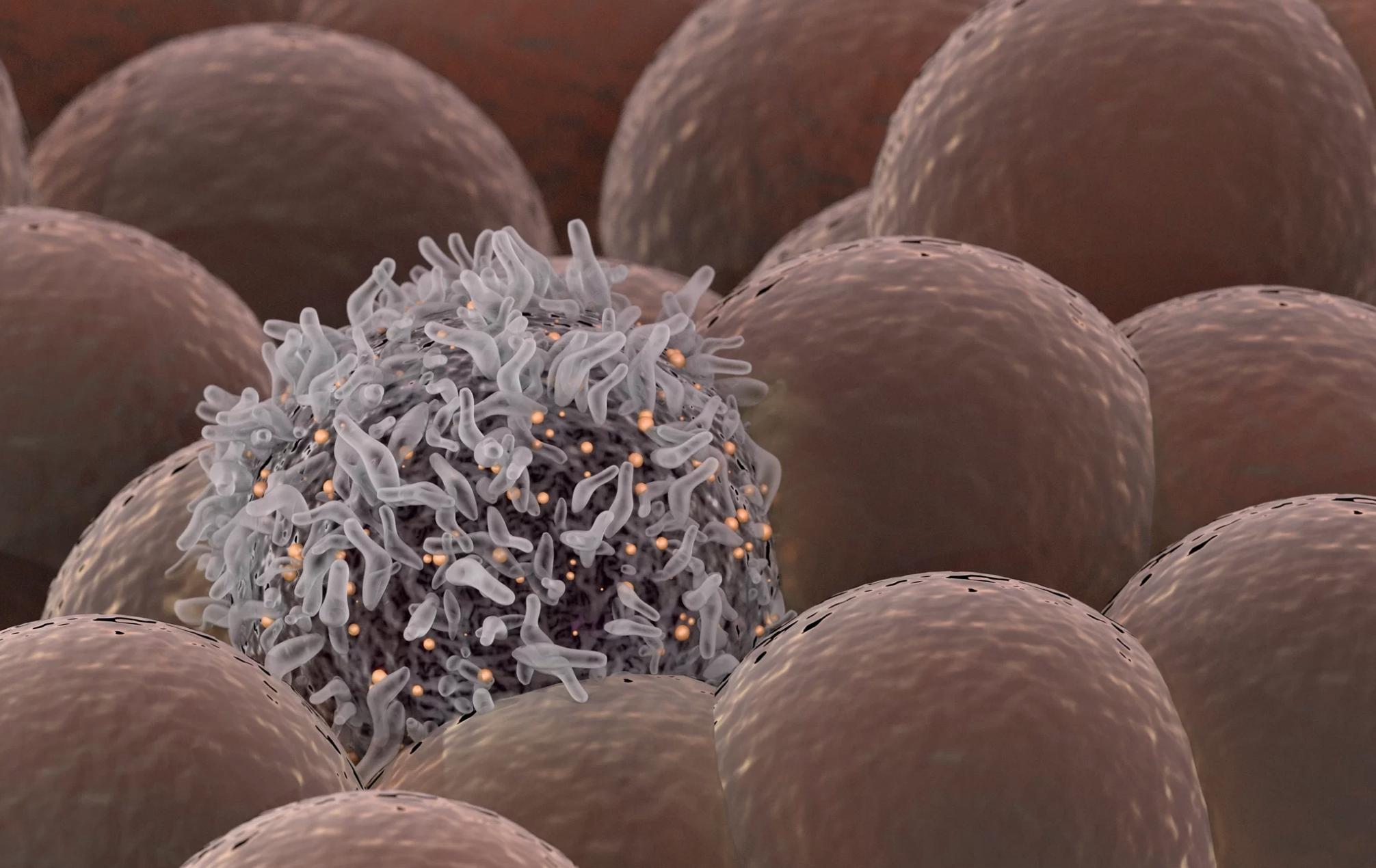 近代可以杀死癌细胞的科技,红外线激光能杀死癌细胞吗