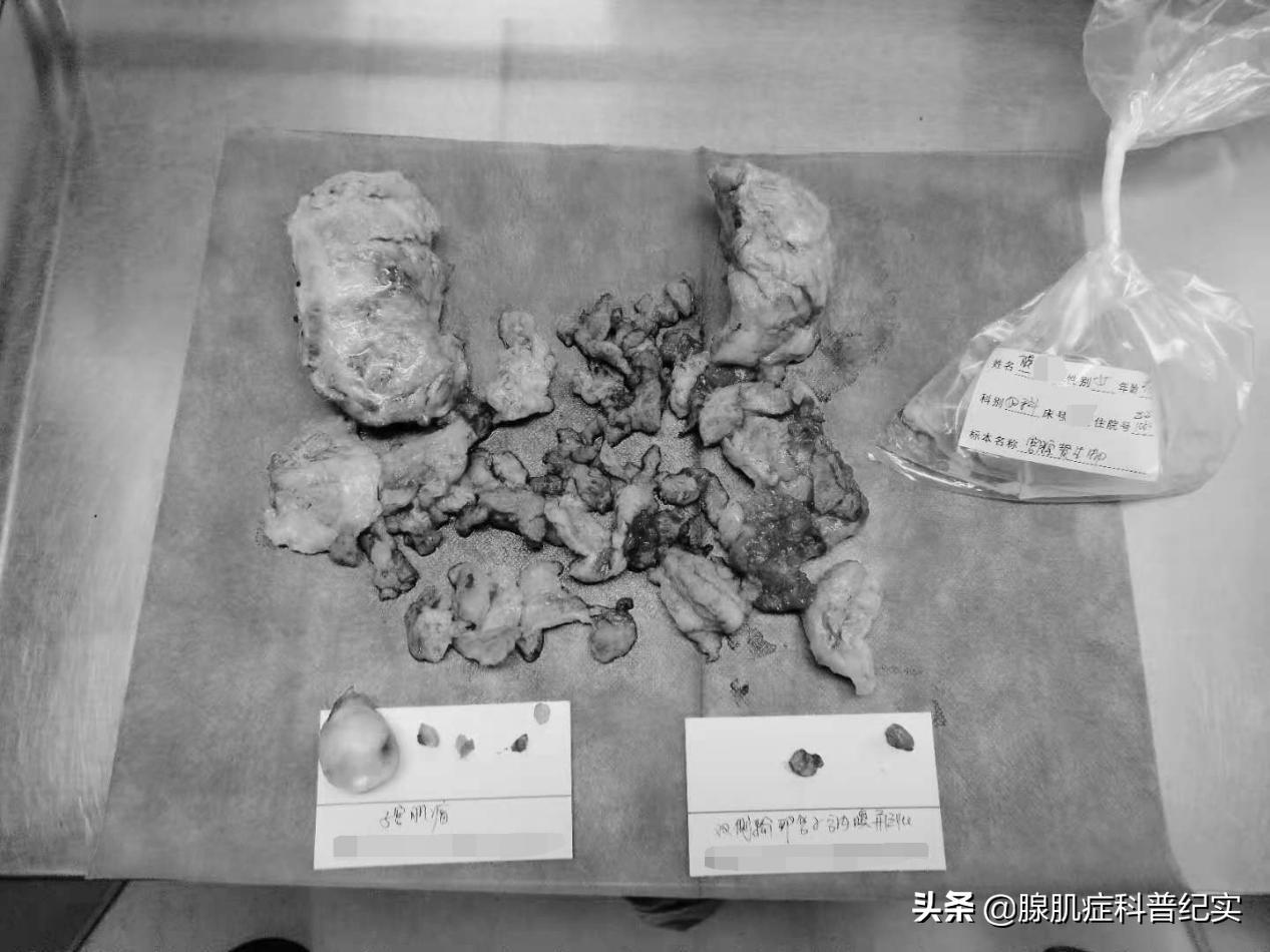 连续服用二十几颗止痛药会怎么样,连续吃7年止痛药