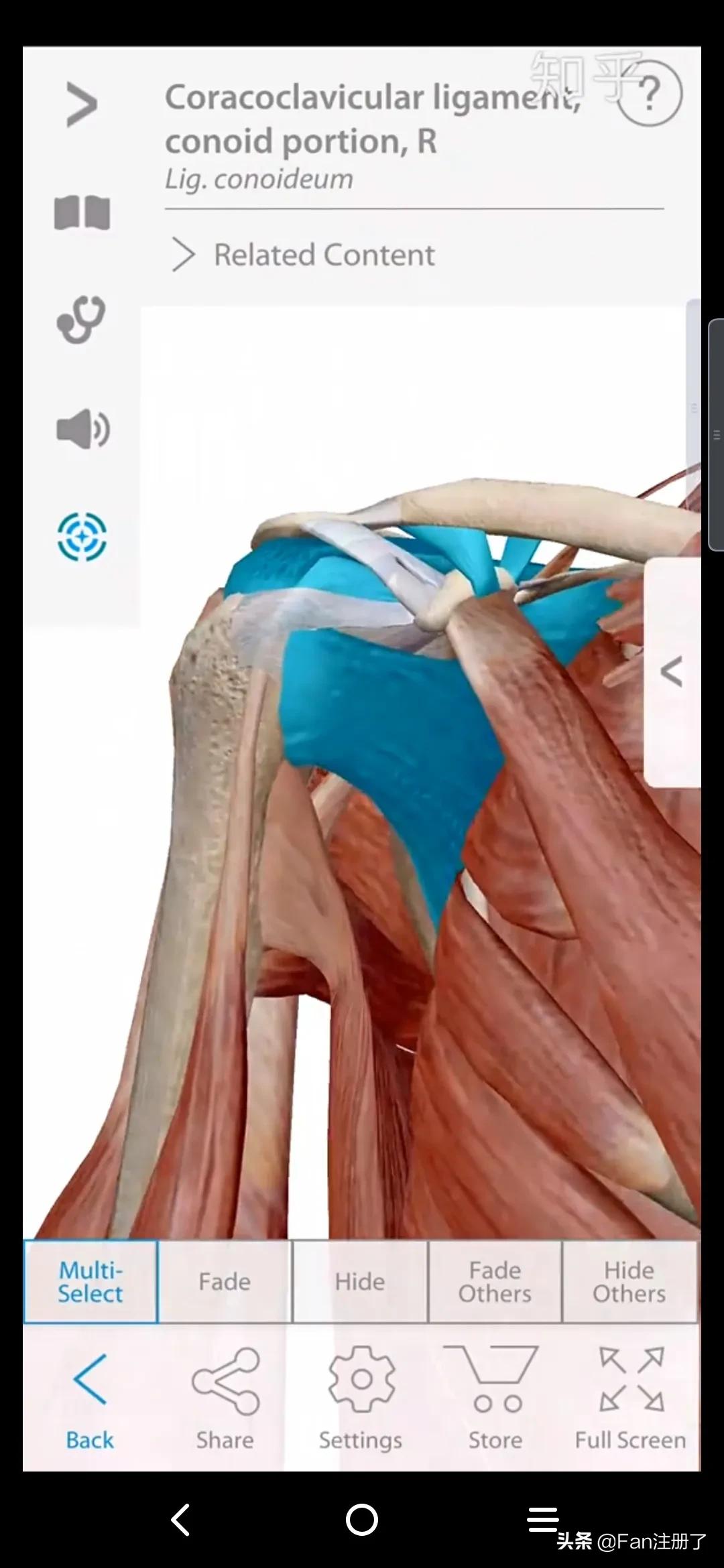 肩痛肩袖损伤针刀治疗,肩痛肩关节活动受限用什么药