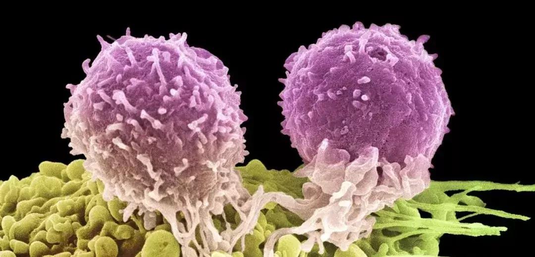 科学家找到癌细胞,科学家找到癌细胞的生死开关论文