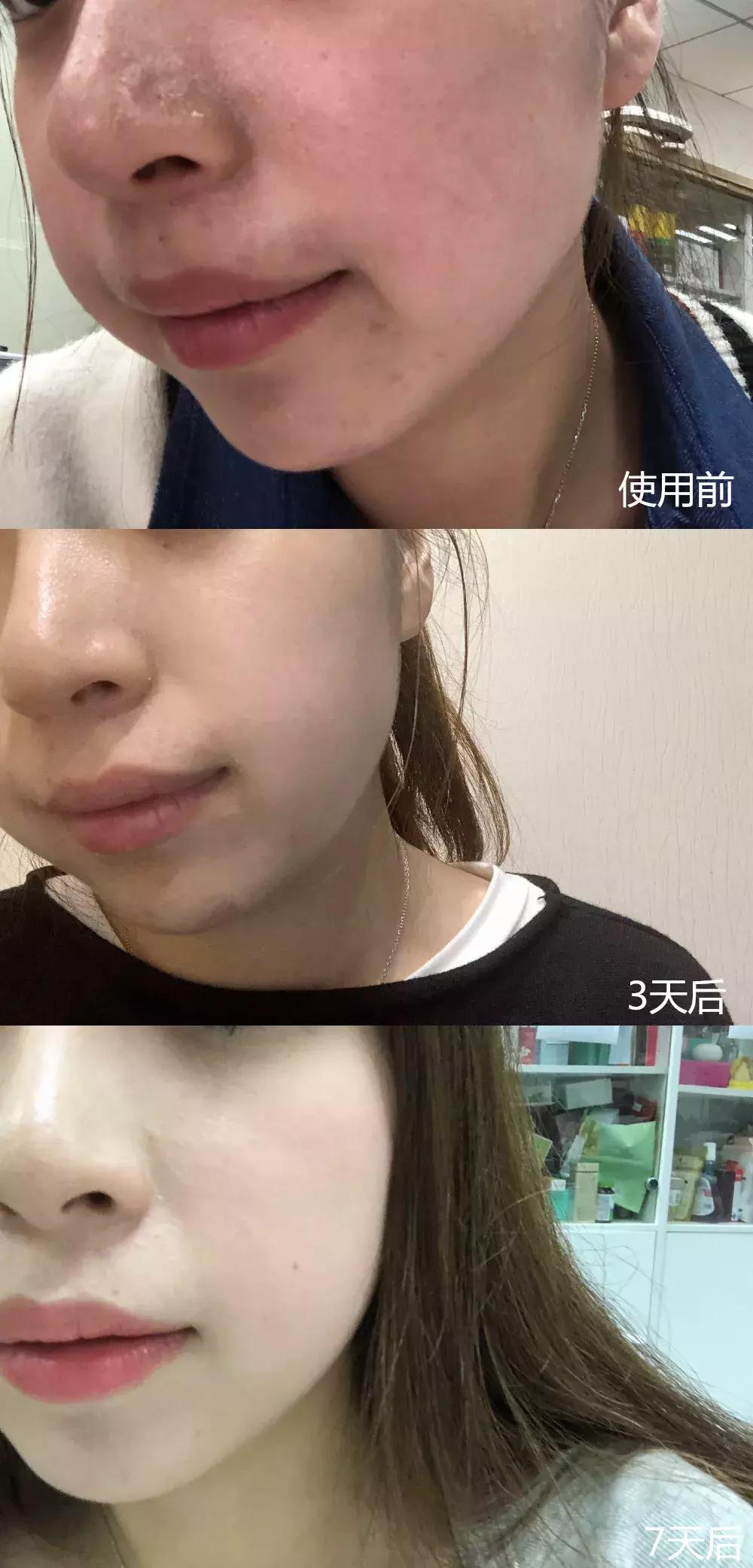 一到晚上皮肤暗沉发黄,一到下午皮肤暗沉