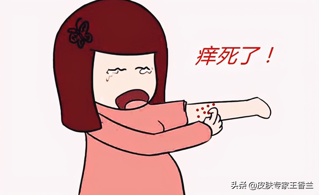 天气热就出来的癣是什么,天气变暖身上就起癣是怎么回事