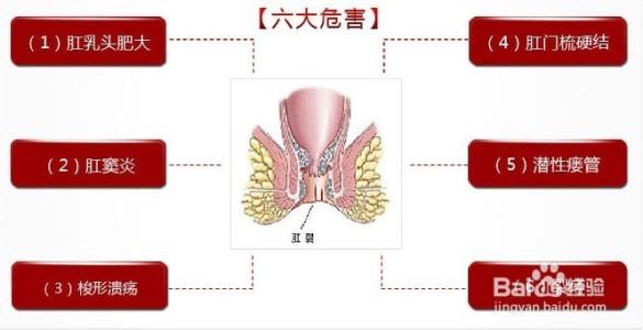 一岁宝宝肛裂后怎么排便,孩子便秘肛裂看什么科大便特别粗