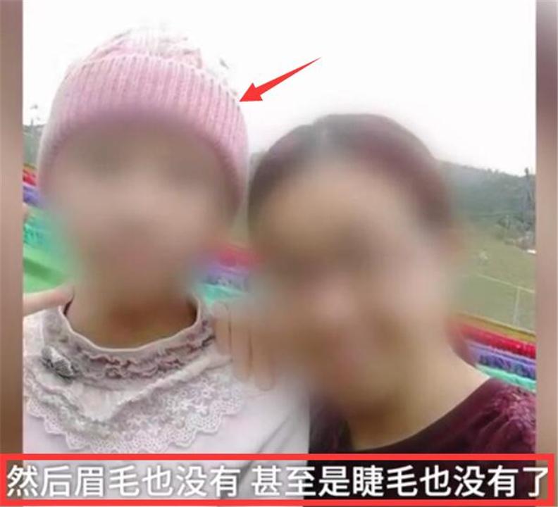 学习压力太大,13岁“学霸”女孩头发*光脱**:孩子的压力如何排解?