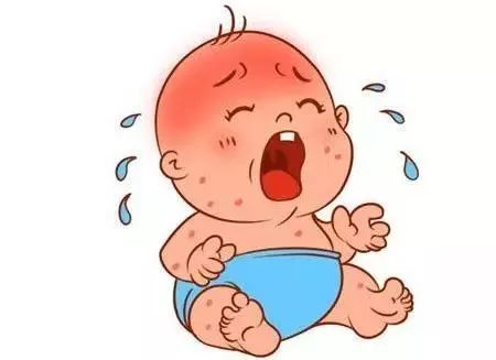 慢性湿疹穿袜子好还是不穿袜子好,湿疹需要保湿还是保持干燥