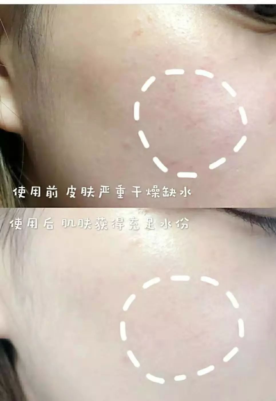 一年四季都能用的保湿面霜,皮肤干推荐一款好用的面霜