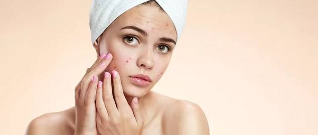 痘痘怎么治都不好不洗脸却好了,痘痘怎么治疗才能彻底治好