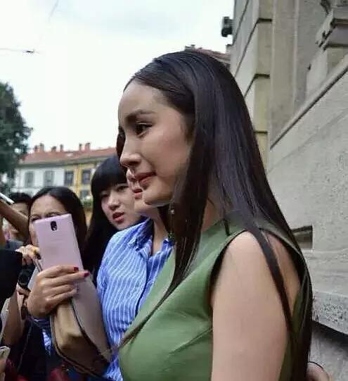 那些一刀切削骨的明星还好吗？后遗症一大堆，小方脸成最大赢家