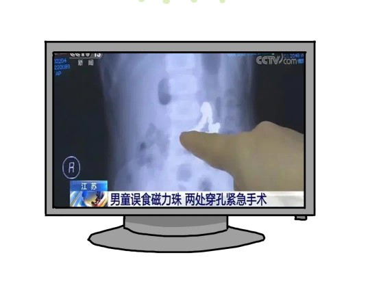 宝宝误吃异物拍ct没有发现,宝宝误食不明异物