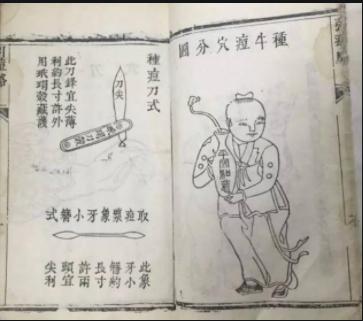 在没疫苗的古代，古代人是这样消灭天花的