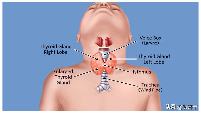 有甲亢能要孩子吗,孩子有甲亢会发烧吗
