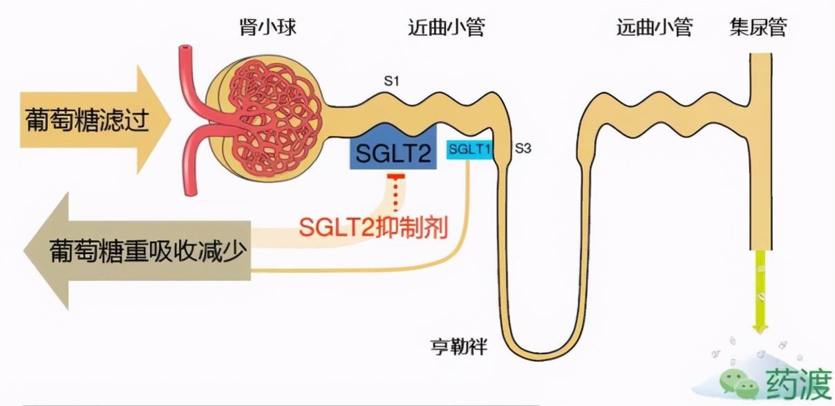 2型糖尿病心血管危险分级,2类糖尿病如何预防