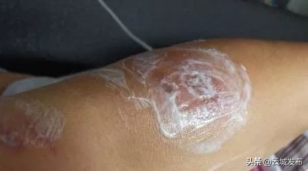 @云浮人虫出没，请注意！