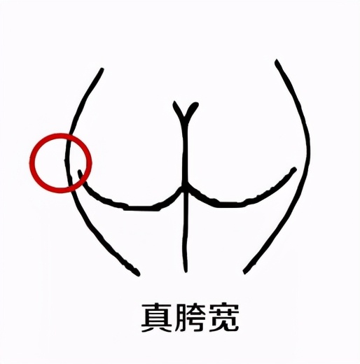 腿粗腿型不好如何改善,腿短而且大腿粗适合穿什么裤子