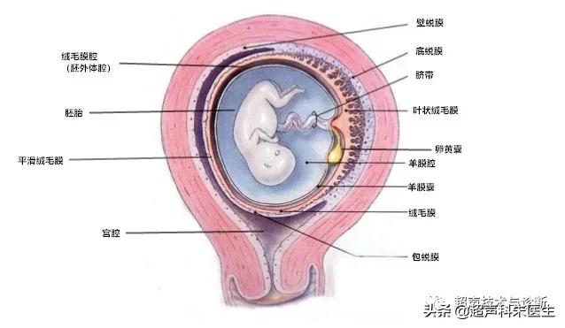 绒毛膜下血肿的超声鉴别诊断,绒毛膜下血肿的症状