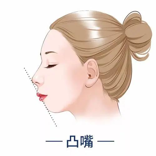 嘴凸的女生其实也很好看,凸嘴女生怎么微笑好看