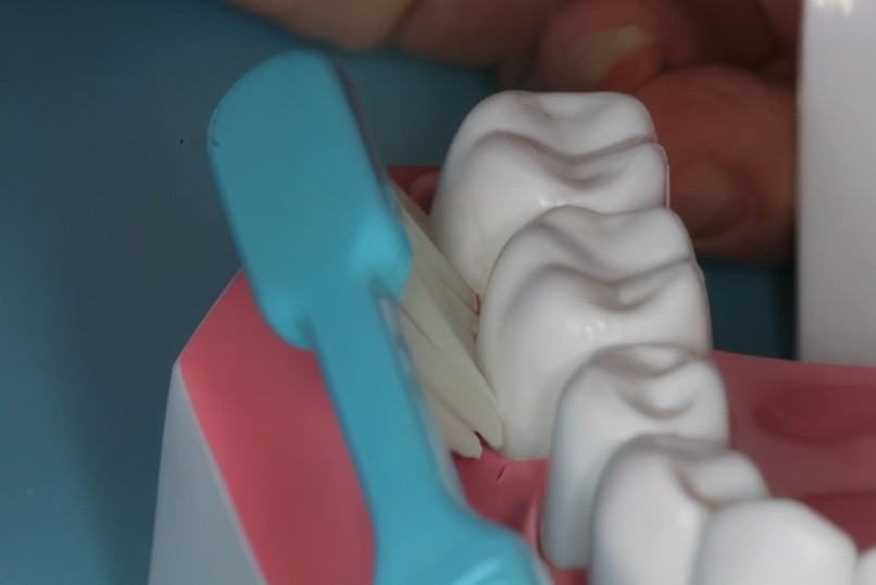 牙周病真实事件,牙周病危害大吗