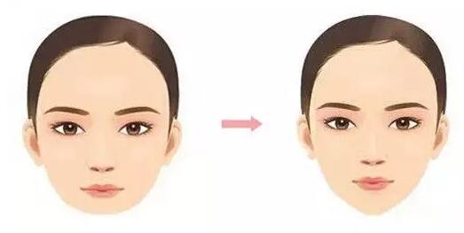 下巴不翘可能不具备这4个标准用这种方法一步解决！