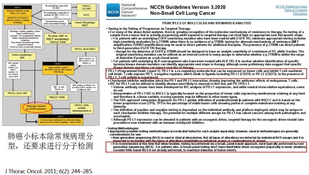 小细胞肺癌的气管镜介入治疗,导航支气管镜在肺癌诊断中的应用