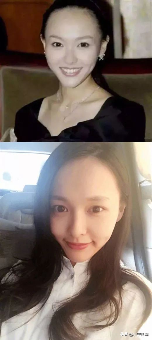 程潇发际线变高的原因为什么,程潇发际线怎么变低了