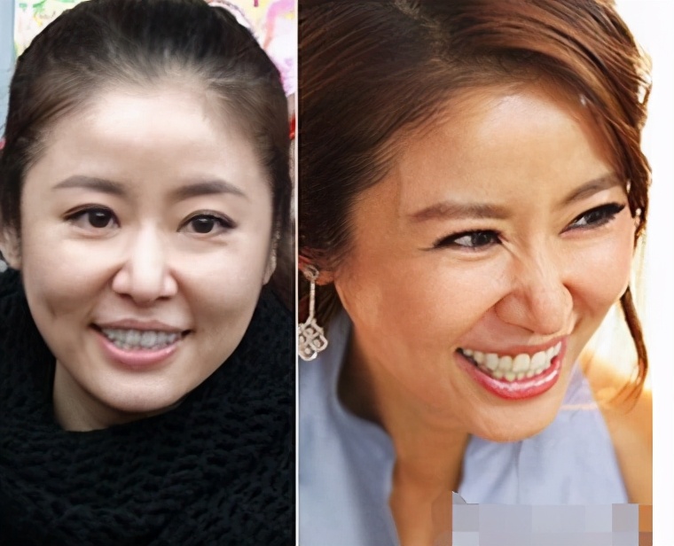 法令纹显老是什么原因,你比同龄人看起来老的原因是什么