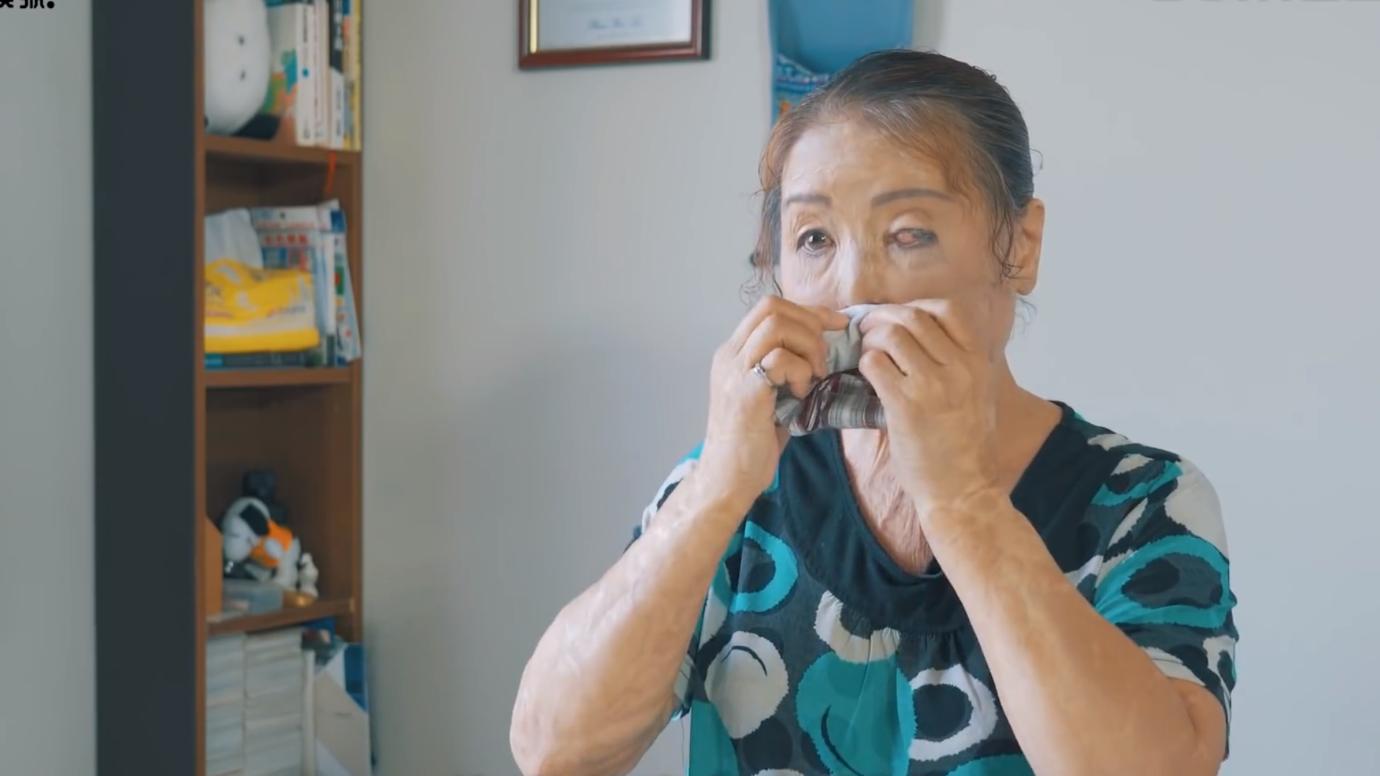 20岁小伙被重度烧伤七年后续,20岁严重烧伤毁容