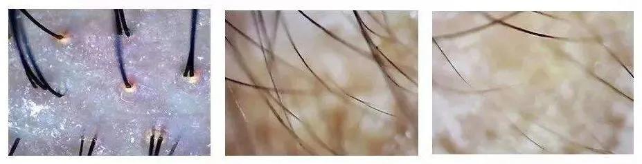 明星亲测力推同款洗发水,康王亲测