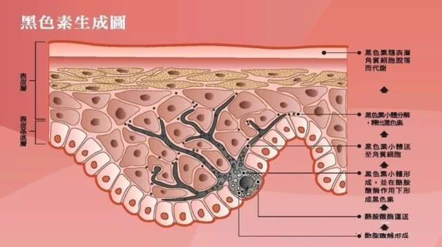 美白祛斑的黑色素真实吗,美白祛斑的护肤品能去除黑色素吗