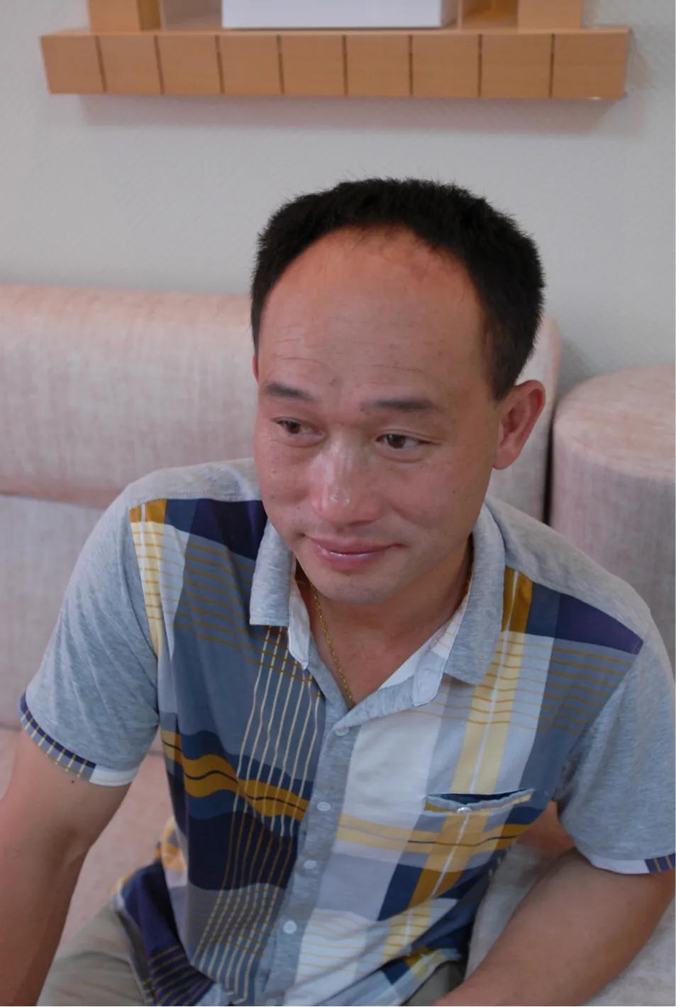 脱发到底该怎么应对,女脱发严重怎么解决