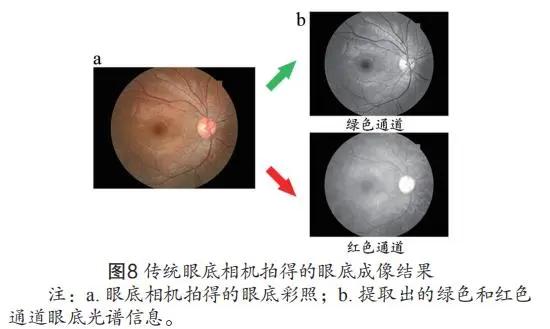 视网膜血氧饱和度测量仪,基于双目视觉的图像测量技术