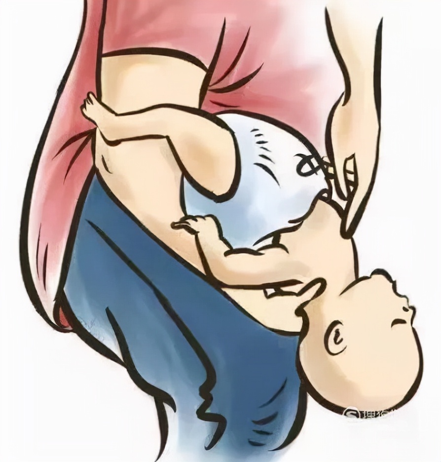 异物卡喉咙海姆立克急救法,食物呛入气管海姆立克解决妙招