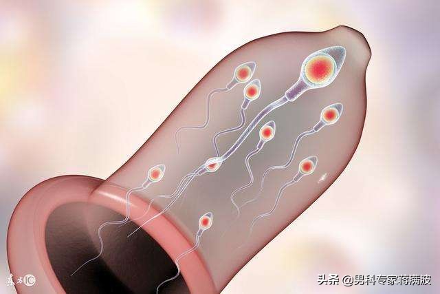 精子走向死亡的4个途径