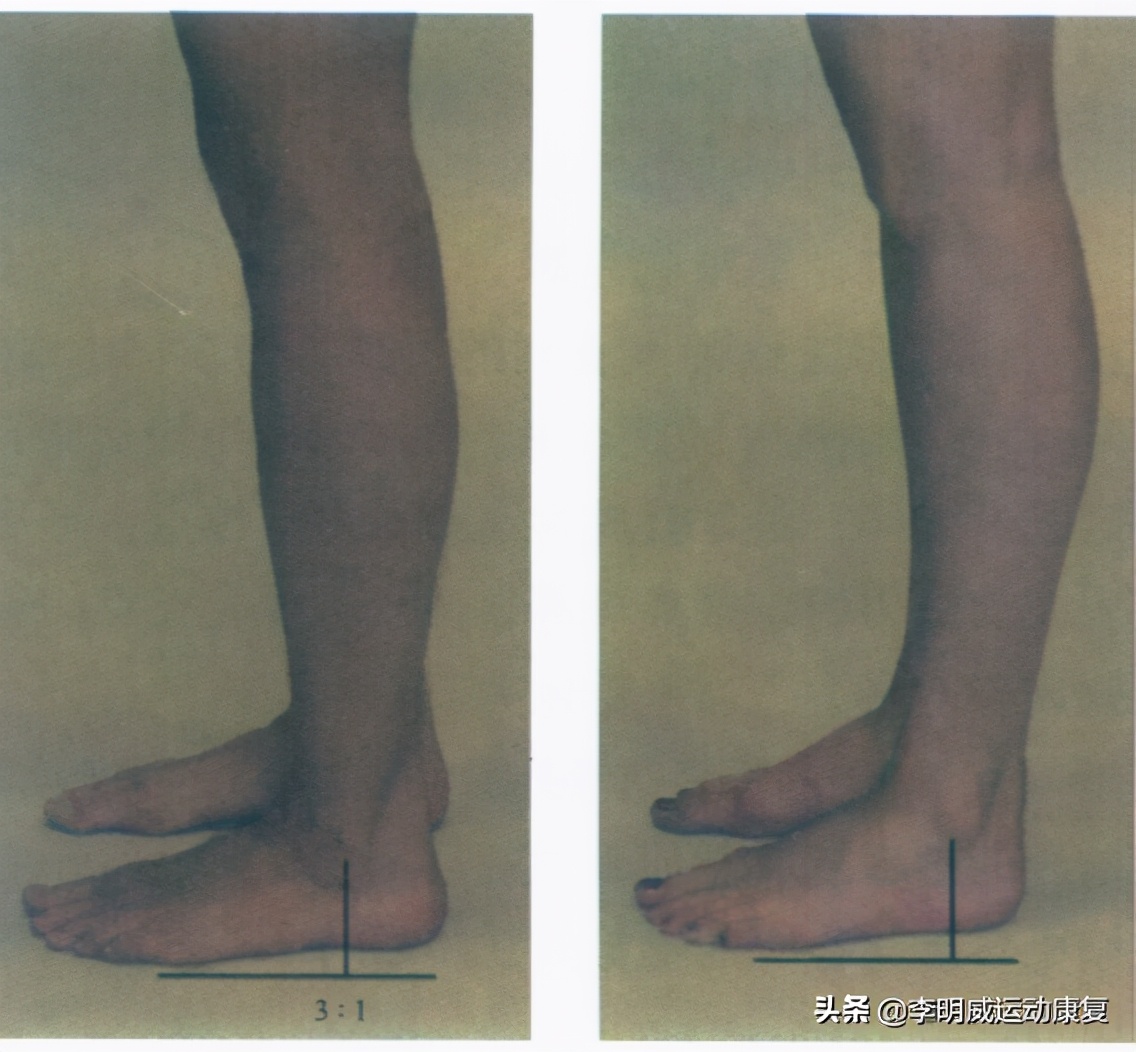 久坐一族如何缓解腰痛,办公室久坐一族腰疼