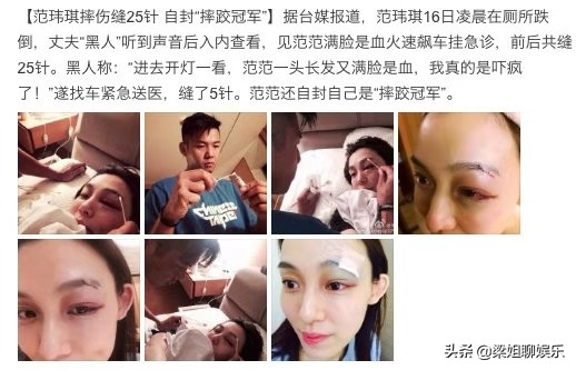 范玮琪摔伤后的图片,范玮琪摔跤最新消息