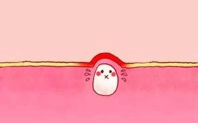 管不住自己的手老是挤痘痘,管不住手喜欢挤痘痘