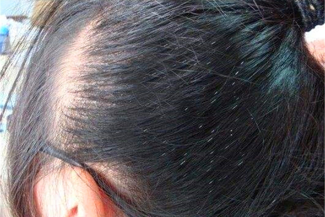 同人类祖先同时进化的人,人类进化了这么久为何还自相残杀