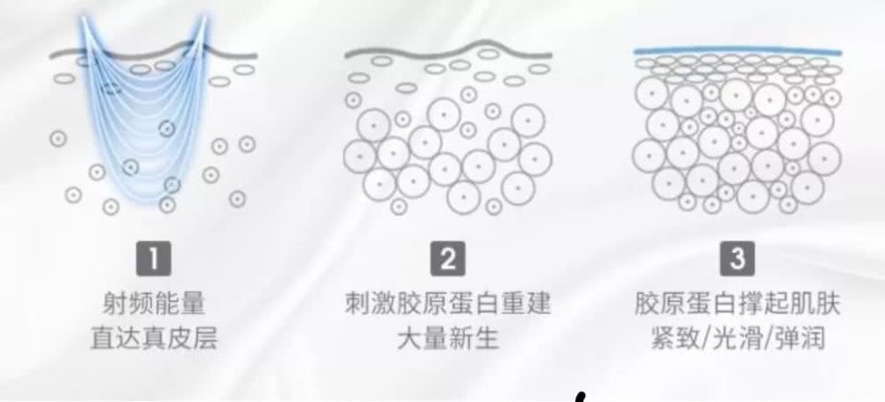 初普射频美容仪测评,家用射频美容仪哪个品牌最好