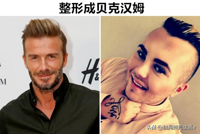 明星模仿秀最像的人图片,疯狂整容把自己整成丑八怪