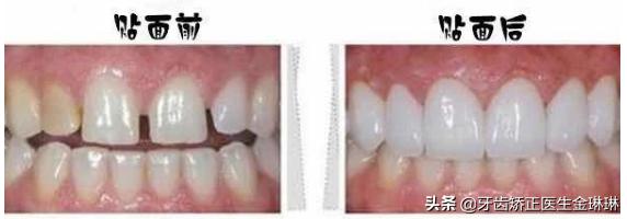 诺尔口腔牙齿矫正怎么样,淄博诺尔漫齿科种植牙价格