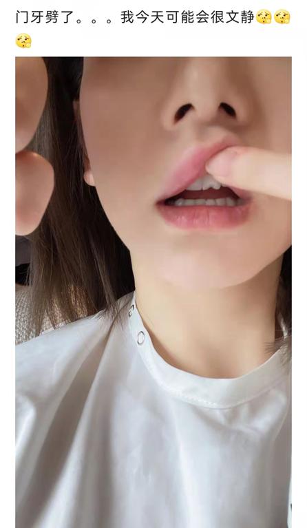 @瓜子*党**和*力暴**开瓶侠看过来!戚薇同款牙,你不pick一下吗