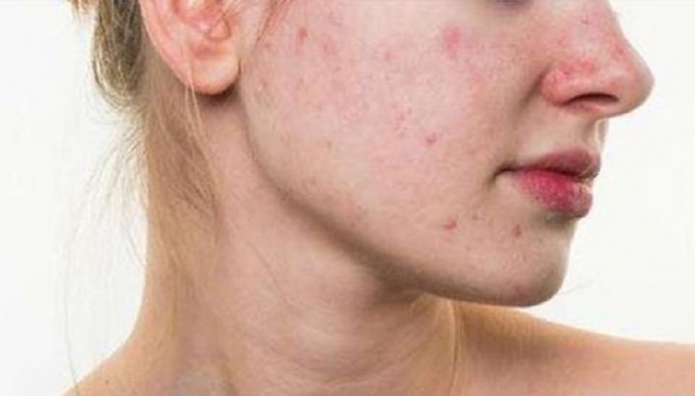 过敏的人都怎么样了,过敏人的反应