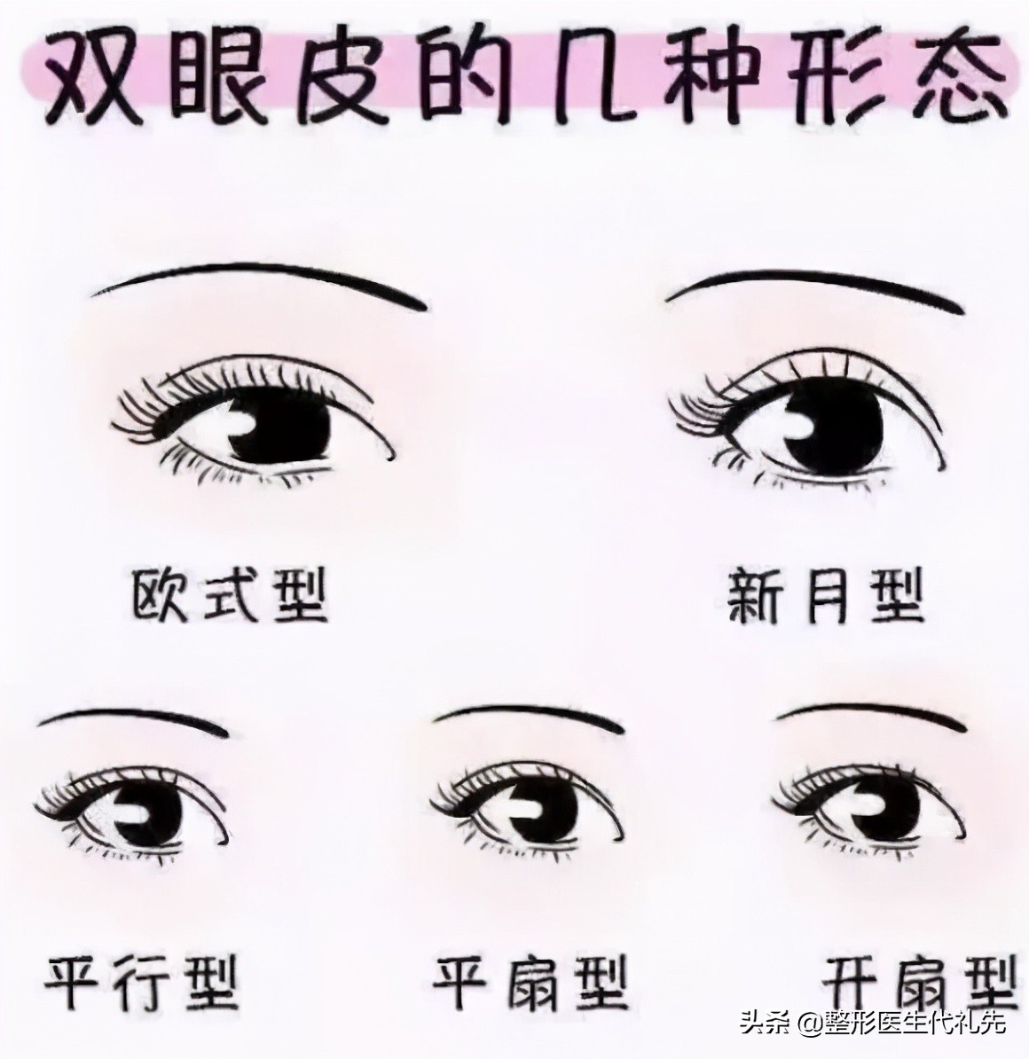 为什么刚做完双眼皮这么难看,为什么刚刚做的双眼皮不好看很假