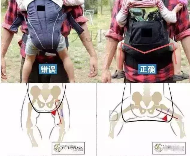 婴儿背带腰凳好还是不带腰凳好,腰凳和背带哪个对宝宝比较舒适