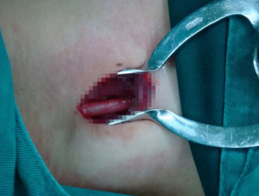 改善言语及认知药,改善记忆力的言语