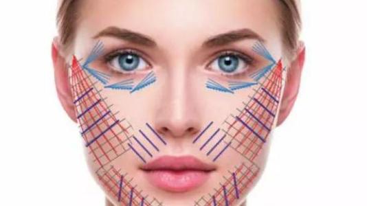 线雕提升如何通过特殊的布线思路将颧骨降低？