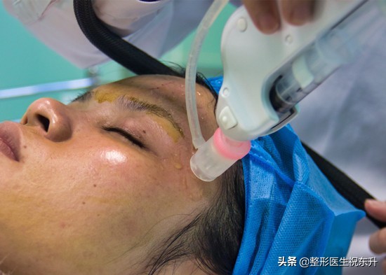 在脸上扎几百万个洞的“水光针”，效果到底怎样？