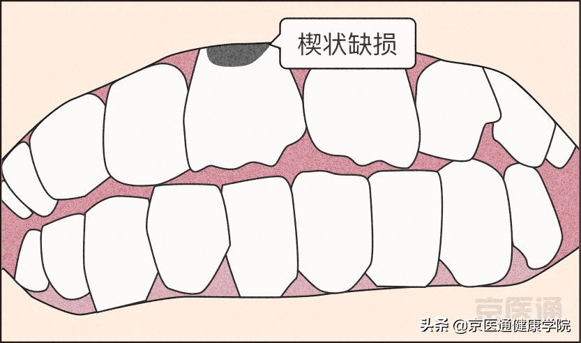 一招解决磨牙的危害,磨牙很严重最好的磨牙解决方法