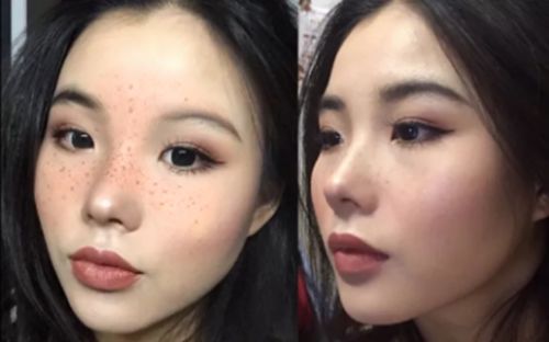 蓝光伤害眼睛怎么治好,蓝光伤害真的不可逆吗该如何预防