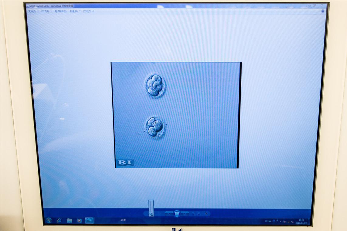 想要试管一次成功？注意这几点，否则影响胚胎着床