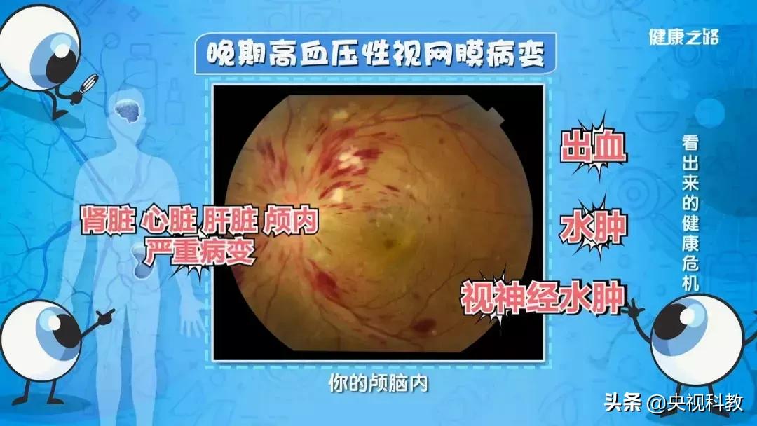 眼底照相全过程,拍一张眼睛的照片